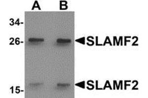 Western blot analysis of SLAMF2 in rat lung tissue lysate with SLAMF2 antibody at (A) 1 and (B) 2 μg/ml. (CD48 antibody  (Center))
