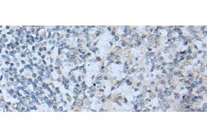 STARD4 antibody