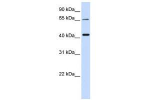QPCTL antibody used at 1 ug/ml to detect target protein. (QPCTL antibody  (Middle Region))
