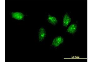 Immunofluorescence of monoclonal antibody to MTA3 on HeLa cell. (MTA3 antibody  (AA 416-515))