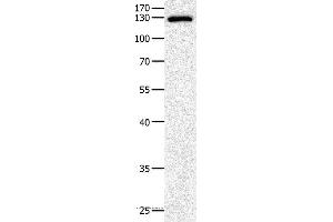 Western blot analysis of Mouse liver tissue, using EGF Polyclonal Antibody at dilution of 1:500 (EGF antibody)