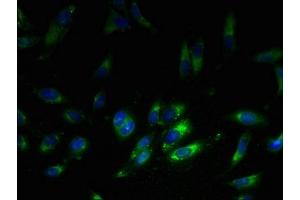 Immunofluorescent analysis of Hela cells using ABIN7142817 at dilution of 1:100 and Alexa Fluor 488-congugated AffiniPure Goat Anti-Rabbit IgG(H+L) (RPL38 antibody  (AA 1-70))