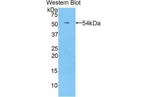 Western Blotting (WB) image for anti-Pregnancy Zone Protein (PZP) (AA 1251-1500) antibody (ABIN1860390)
