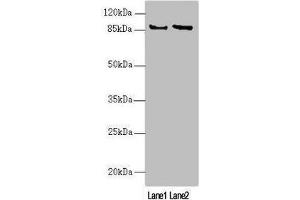 Western blot All lanes: MAPK8IP2 antibody at 2. (IB2 antibody  (AA 470-570))