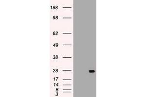 Image no. 3 for anti-Interleukin 6 (IL6) (AA 29-212) antibody (ABIN1491342) (IL-6 antibody  (AA 29-212))