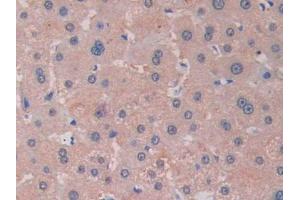 DAB staining on IHC-P; Samples: Human Liver Tissue (RNASE13 antibody  (AA 20-156))
