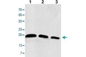 Western blot analysis of the extracts of Jurkat cells Lane 1: 30 ug, Lane 2: 20 ug, Lane 3: 10 ug with RAC2 monoclonal antibody, clone AT2G11  at 1:1000 dilution. (RAC2 antibody  (AA 1-189))