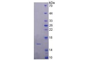 Image no. 1 for Dopamine Receptor D1 (DRD1) (AA 338-446) protein (His tag) (ABIN4988656)