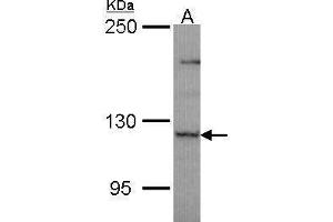 WB Image Sample (30 ug of whole cell lysate) A: JurKat 5% SDS PAGE antibody diluted at 1:1000 (PLEKHG4 antibody  (N-Term))