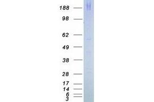 Western Blotting (WB) image for Mechanistic Target of Rapamycin (serine/threonine Kinase) (mTOR) (Active) protein (Myc-DYKDDDDK Tag) (ABIN2726555)