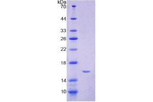 SDS-PAGE analysis of Human Hepcidin Protein. (Hepcidin Protein)