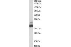 Western Blotting (WB) image for anti-rho Guanine Nucleotide Exchange Factor (GEF) 40 (ARHGEF40) (Middle Region) antibody (ABIN2774352)