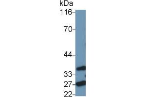 Detection of FADD in Rat Spleen lysate using Polyclonal Antibody to Fas Associating Death Domain Containing Protein (FADD) (FADD antibody  (AA 7-178))