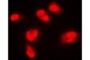 Immunofluorescent analysis of SPHK1 staining in Hela cells. (SPHK1 antibody)