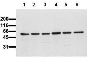 Western Blotting (WB) image for anti-V-Akt Murine Thymoma Viral Oncogene Homolog 1 (AKT1) (AA 466-480) antibody (ABIN126858) (AKT1 antibody  (AA 466-480))