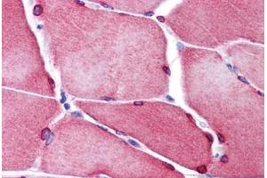 Human Skeletal Muscle: Formalin-Fixed, Paraffin-Embedded (FFPE) (TMEM38A antibody  (C-Term))