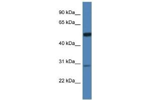 Western Blot showing IDS antibody used at a concentration of 1 ug/ml against Hela Cell Lysate