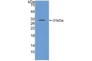 Western blot analysis of recombinant Human TGFbR1. (TGFBR1 antibody  (AA 162-403))