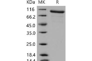 Western Blotting (WB) image for Matrix Metallopeptidase 9 (Gelatinase B, 92kDa Gelatinase, 92kDa Type IV Collagenase) (MMP9) protein (ABIN7320233) (MMP 9 Protein)