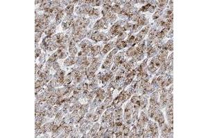 Immunohistochemical staining of human liver with RASA2 polyclonal antibody  shows strong granular positivity in hepatocytes at 1:50-1:200 dilution.