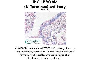 Image no. 2 for anti-Prominin 2 (PROM2) (N-Term) antibody (ABIN1738405) (Prominin 2 antibody  (N-Term))