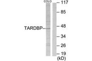 Western blot analysis of extracts from COLO205 cells, using TBX1 Antibody. (T-Box 1 antibody  (AA 311-360))