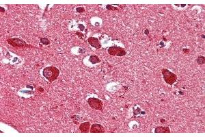 Immunohistochemistry (IHC) image for anti-Hexosaminidase B (Beta Polypeptide) (HEXB) (AA 315-456) antibody (ABIN7432289)