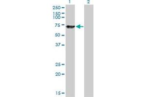 Western Blot analysis of SWAP70 expression in transfected 293T cell line by SWAP70 monoclonal antibody (M09), clone 3H8. (SWAP70 antibody  (AA 378-451))