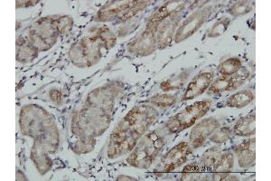 Immunostaining (ISt) image for anti-Ribosomal Protein S6 Kinase, 90kDa, Polypeptide 6 (RPS6KA6) (AA 636-745) antibody (ABIN565375)