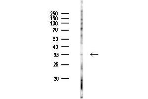 anti-Olfactory Receptor, Family 3, Subfamily A, Member 2 (OR3A2) (C-Term) antibody