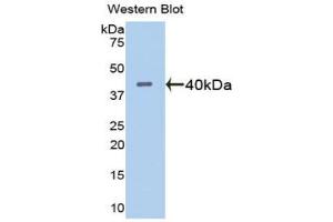 Western blot analysis of the recombinant protein.