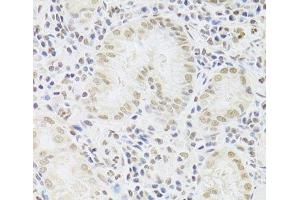 Immunohistochemistry (Paraffin-embedded Sections) (IHC (p)) image for anti-Small Nuclear Ribonucleoprotein Polypeptide A (SNRPA) antibody (ABIN7262230)