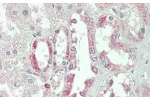 Detection of JAG1 in Human Kidney Tissue using Polyclonal Antibody to Jagged 1 (JAG1) (JAG1 antibody  (AA 836-1047))