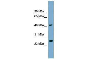 WB Suggested Anti-FLJ25439 Antibody Titration: 0. (TTC23L antibody  (N-Term))