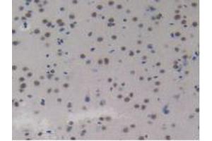 IHC-P analysis of Mouse Brain Tissue, with DAB staining. (CCL8 antibody  (AA 20-94))