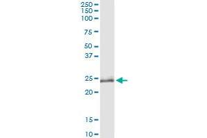 Immunoprecipitation of OIP5 transfected lysate using anti-OIP5 MaxPab rabbit polyclonal antibody and Protein A Magnetic Bead , and immunoblotted with OIP5 purified MaxPab mouse polyclonal antibody (B01P) . (OIP5 antibody  (AA 1-229))