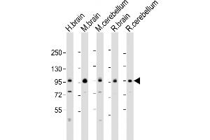 All lanes : Anti-DLG4 Antibody (C-erm) at 1:2000 dilution Lane 1: human brain lysate Lane 2: mouse brain lysate Lane 3: mouse cerebellum lysate Lane 4: rat brain lysate Lane 5: rat cerebellum lysate Lysates/proteins at 20 μg per lane. (DLG4 antibody  (AA 548-579))