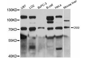 Western blot analysis of extracts of various cell lines, using OS9 antibody (ABIN5998420) at 1:3000 dilution. (OS9 antibody)