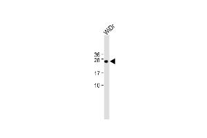 All lanes : Anti-C9orf95 Antibody (N-term) at 1:1000 dilution Lane 1: WiDr whole cell lysate Lysates/proteins at 20 μg per lane. (NMRK1 antibody  (N-Term))