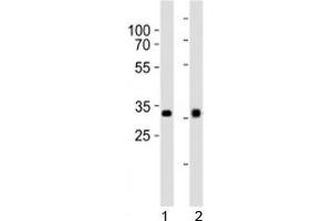 Western blot analysis of lysate from 1) HepG2 and 2) Y79 cell line using OTX2 antibody at 1:1000.