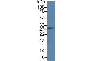 Western Blot; Sample: Mouse Lymph node lysate; Primary Ab: 3µg/ml Rabbit Anti-Human LAT Antibody Second Ab: 0. (LAT antibody  (AA 25-221))