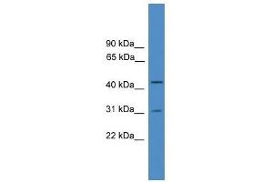 Western Blot showing OTUD6A antibody used at a concentration of 1-2 ug/ml to detect its target protein. (OTUD6A antibody  (Middle Region))