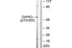 Western blot analysis of extracts from HuvEc cells, using DAPK3 (Phospho-Thr265) Antibody. (DAPK3 antibody  (pThr265))
