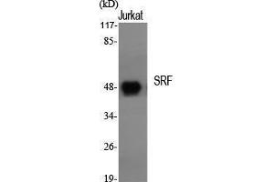 Western Blotting (WB) image for anti-Serum Response Factor (SRF) (Tyr118) antibody (ABIN3187054) (SRF antibody  (Tyr118))
