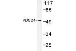 Western blot analyzes of PDCD4 antibody in extracts from 293 cells. (PDCD4 antibody)