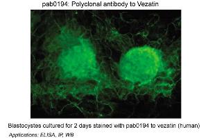 Image no. 1 for anti-Vezatin, Adherens Junctions Transmembrane Protein (VEZT) antibody (ABIN347059) (VEZT antibody)