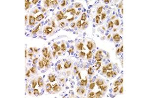 Immunohistochemistry of paraffin-embedded Human gastric using KCNN3 antibody at dilution of 1:100 (x400 lens).