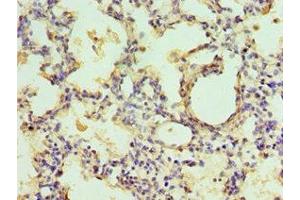 Immunohistochemistry of paraffin-embedded human lung tissue using ABIN7151443 at dilution of 1:100 (EGLN1 antibody  (AA 301-426))