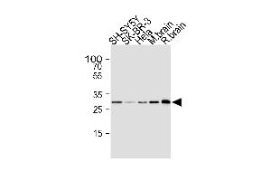 Western blot analysis of lysates from SH-SY5Y, SK-BR-3, Hela cell line, mouse brain and rat brain tissue lysate(from left to right), using CDK5 Antibody (ABIN1945087 and ABIN2843647). (CDK5 antibody)
