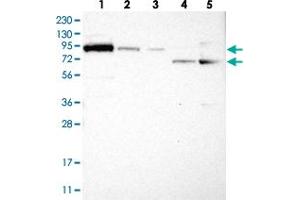 Western blot analysis of Lane 1: RT-4, Lane 2: U-251 MG, Lane 3: Human Plasma, Lane 4: Liver, Lane 5: Tonsil with FAM129B polyclonal antibody . (MEG3 antibody)